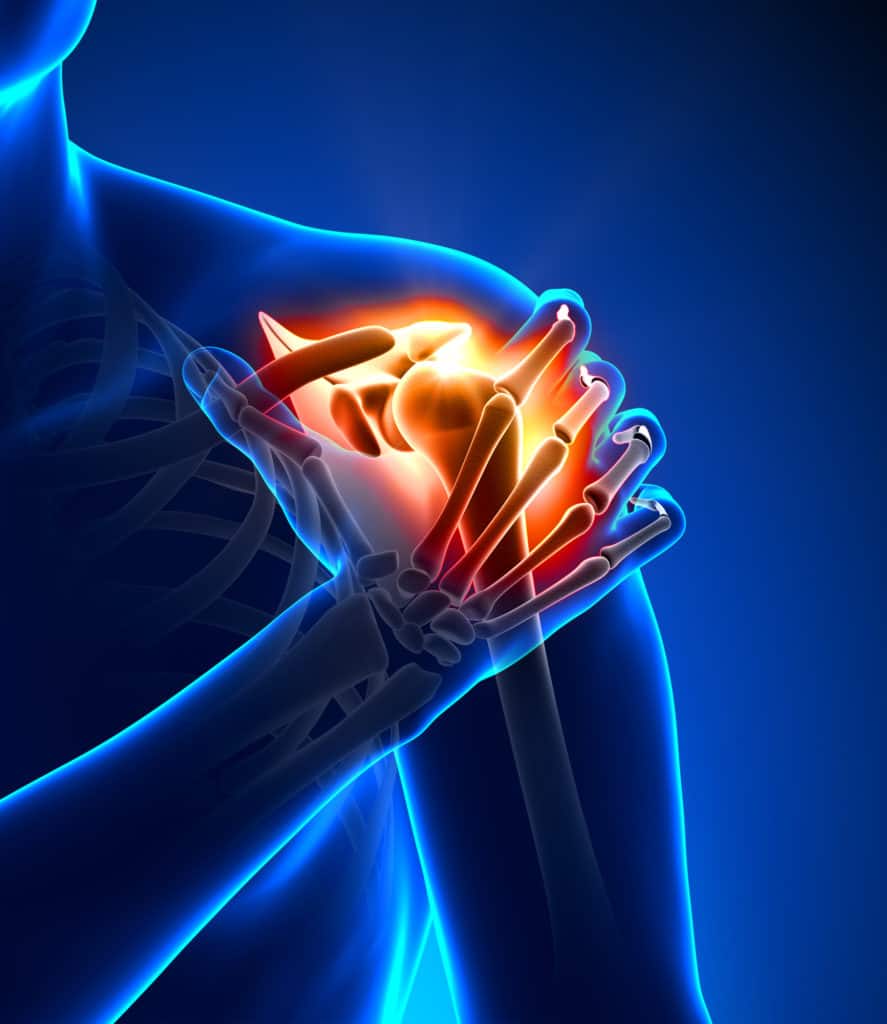 Shoulder pain caused by rotator cuff injury 