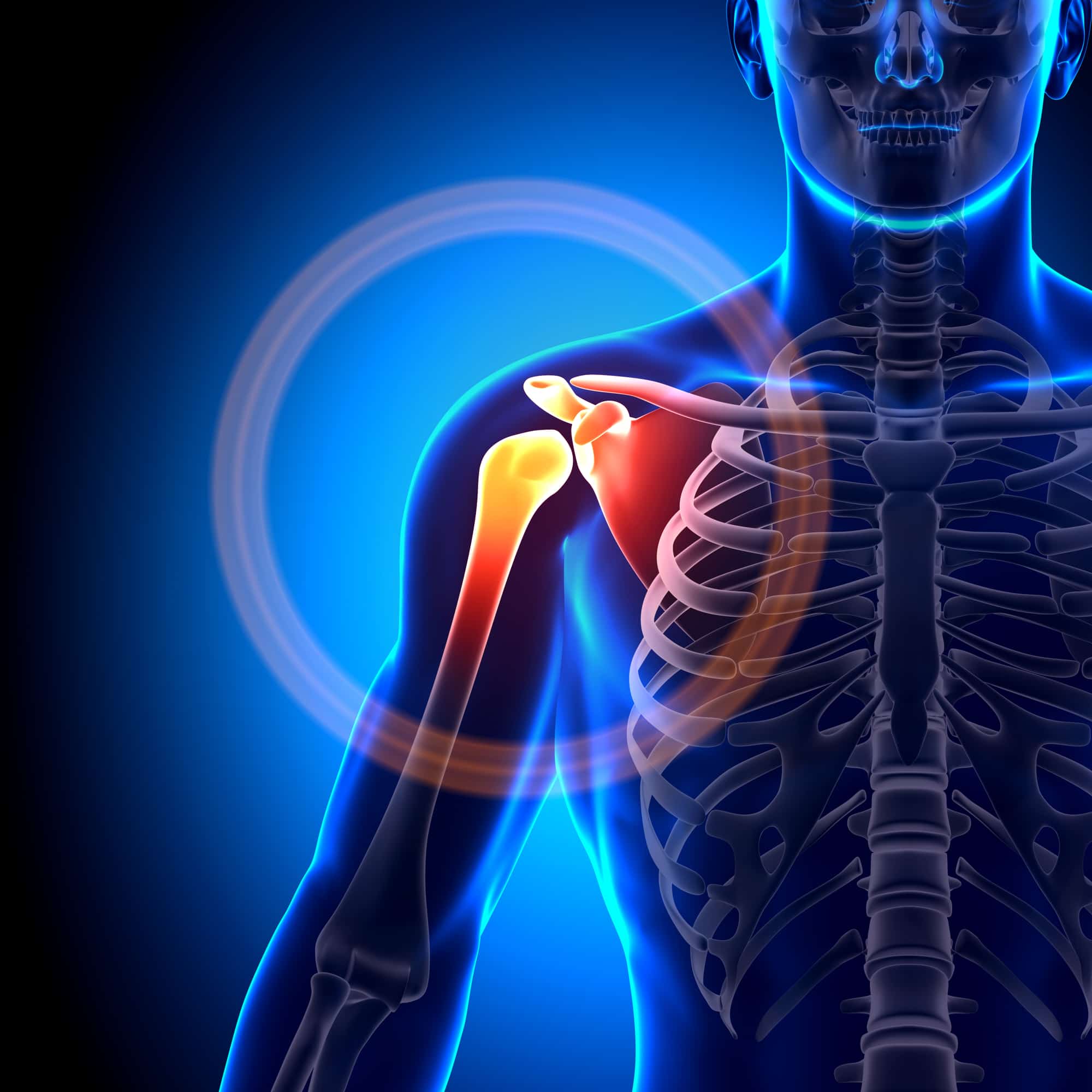 The Worst Activities You Can Do with Rotator Cuff & Shoulder Pain