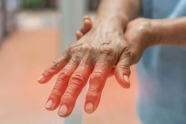 Traveling with Neuropathy in Summer: Prevent Discomfort and Stay Mobile